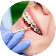 ortodoncia en implantd el bordo